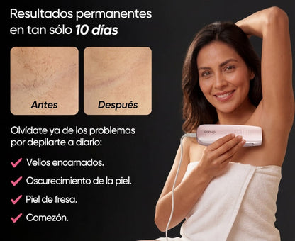 SkinUp Pro™ | Laser Permanente
