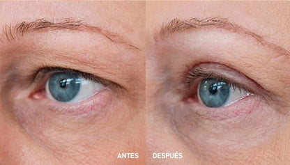 KIT LEVANTA PÁRPADOS CINTA MAGICA